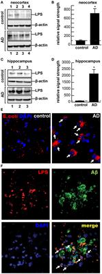 Microbiome-Derived Lipopolysaccharide Enriched in the Perinuclear Region of Alzheimer’s Disease Brain